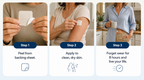 Shape Control Patches